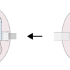 Hot to implement securement device