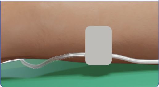 Leg Strap